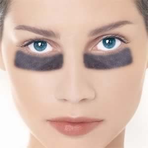 dark-circles-under-eye